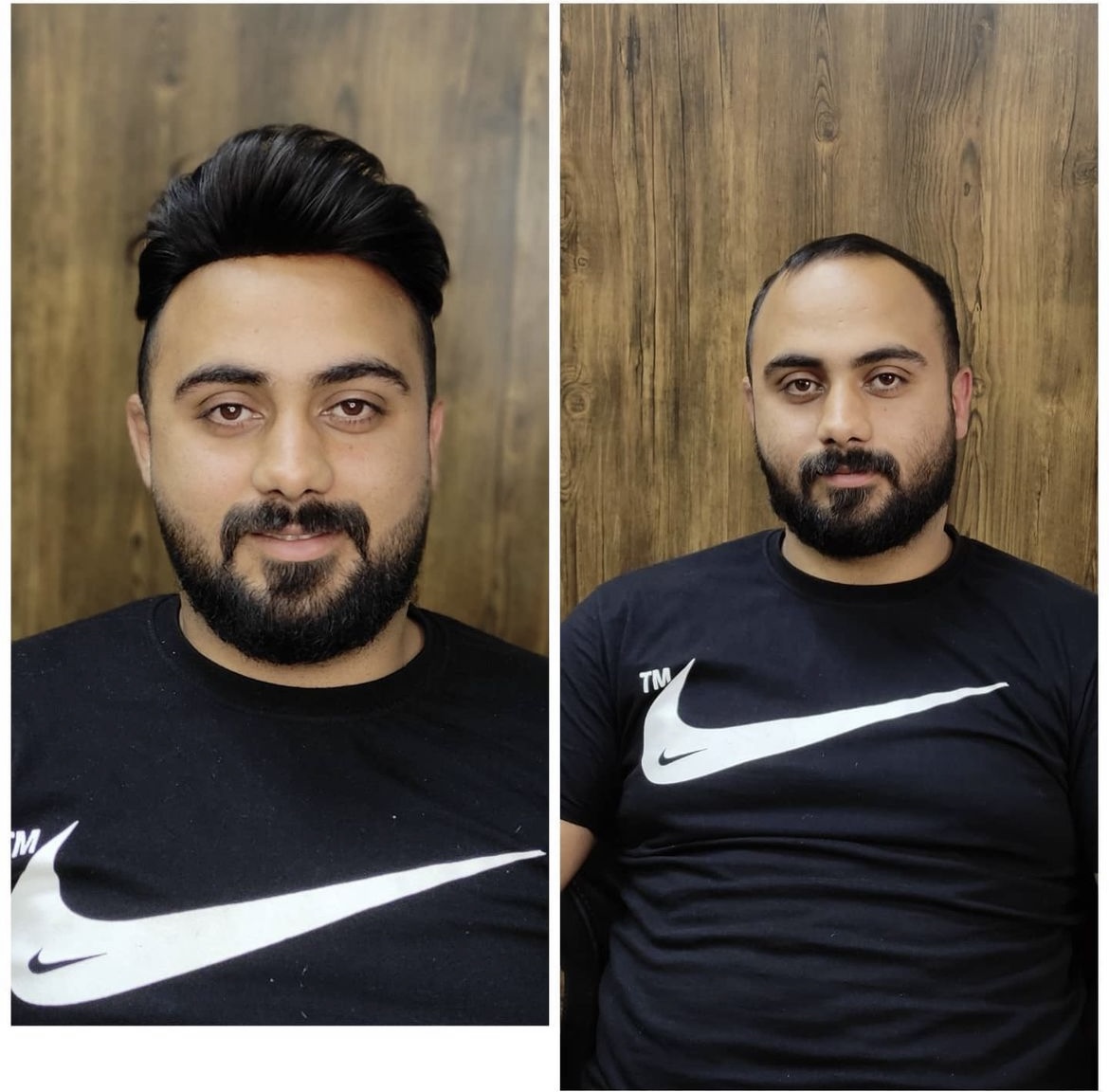 بهترین کلینیک پروتز مو در مازندران